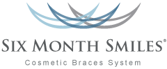 Six Month Smiles Braces in San Diego - Governor Dental